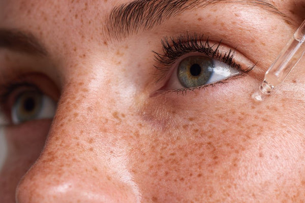 How to Choose the Best Serum for Dark Spots and Hyperpigmentation