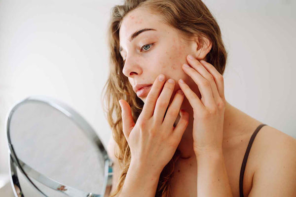 Sensitive Skin Care Tips to Reduce Redness and Irritation