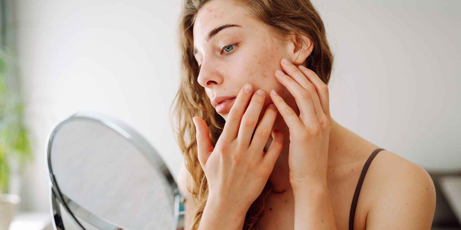Sensitive Skin Care Tips to Reduce Redness and Irritation