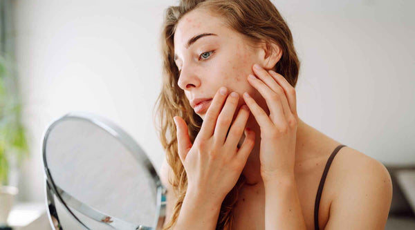Sensitive Skin Care Tips to Reduce Redness and Irritation